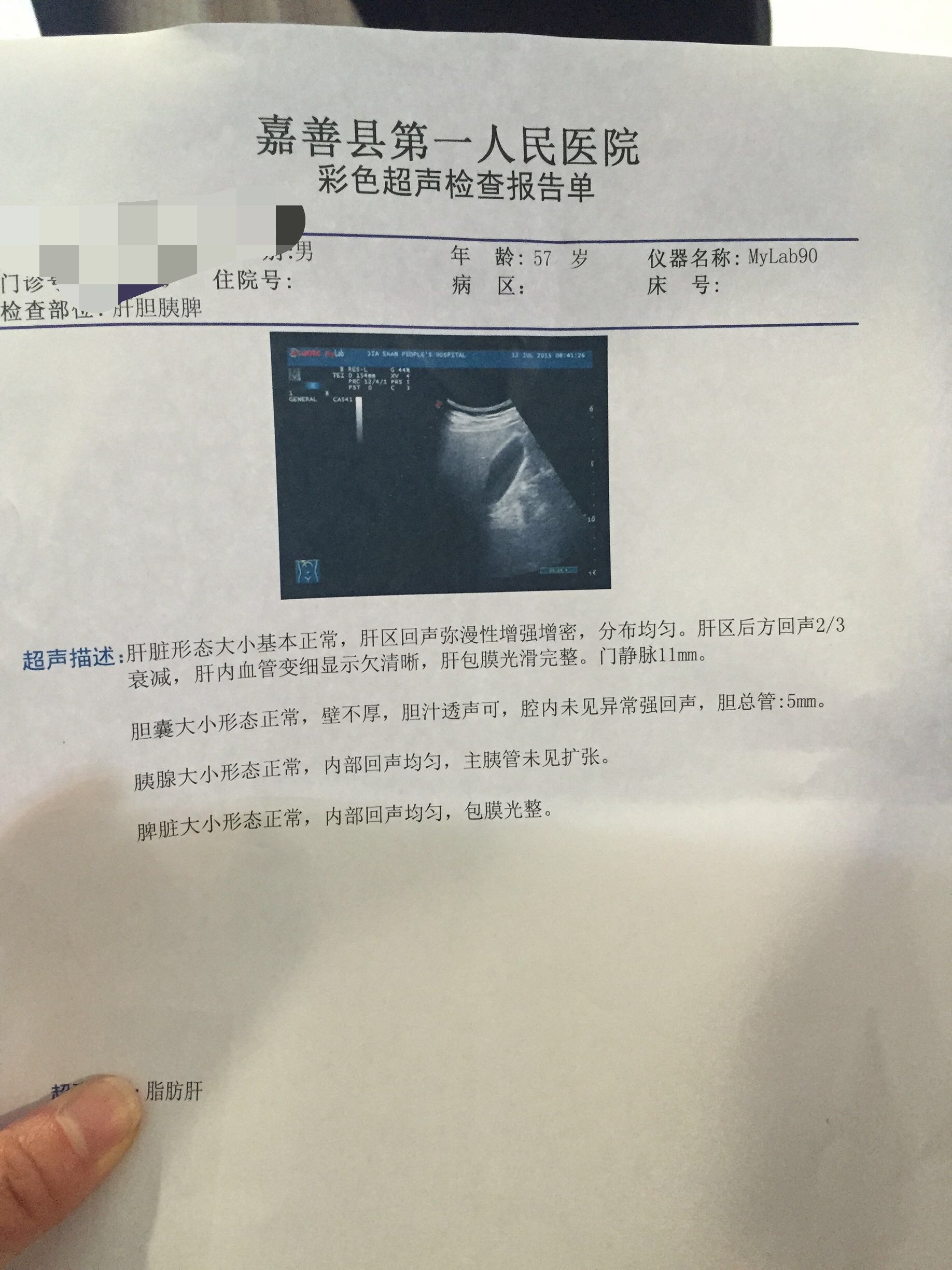 肝脏B超报告