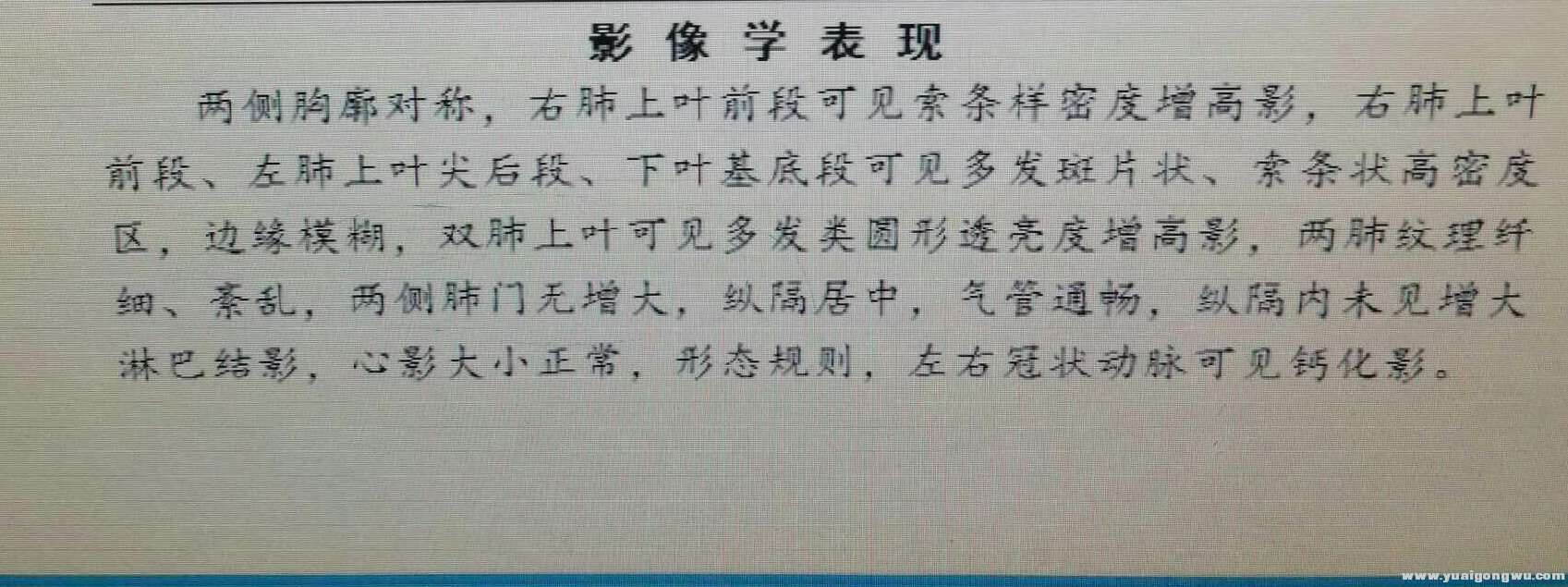 八月份CT结果2