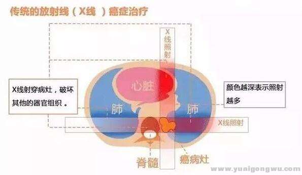 图一