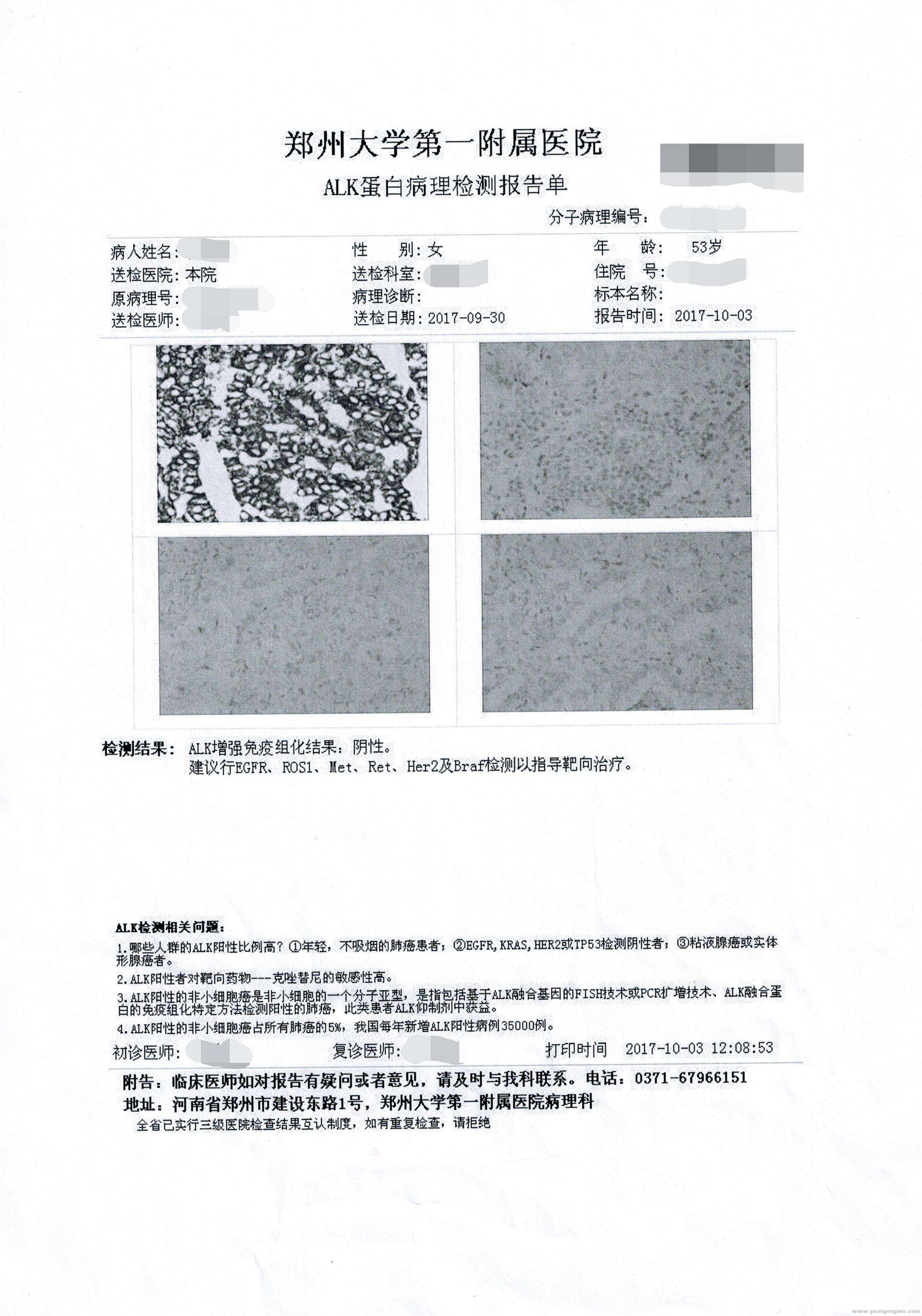 ALK蛋白病理检测报告单.jpg